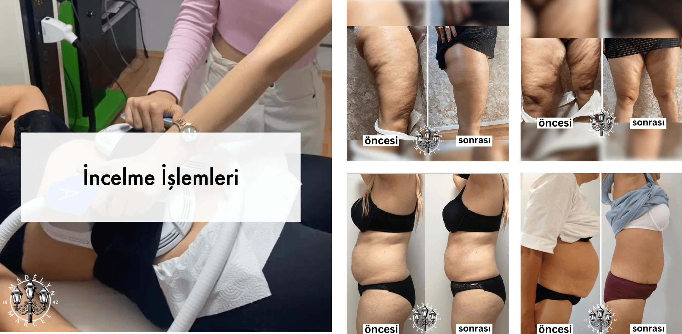 İncelme İşlemleri