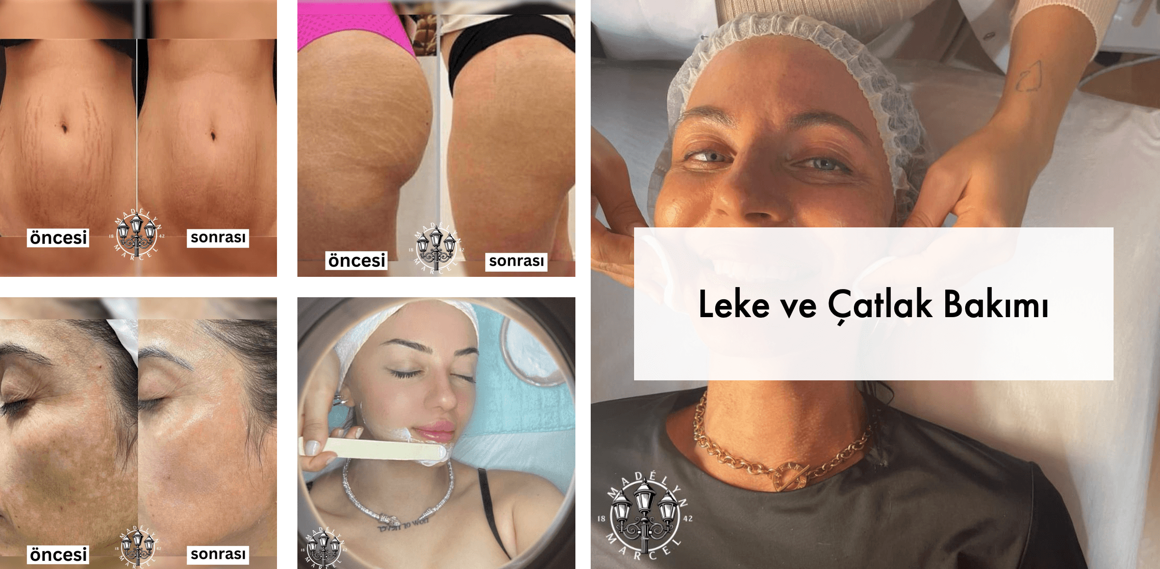 Leke ve Çatlak Bakımı